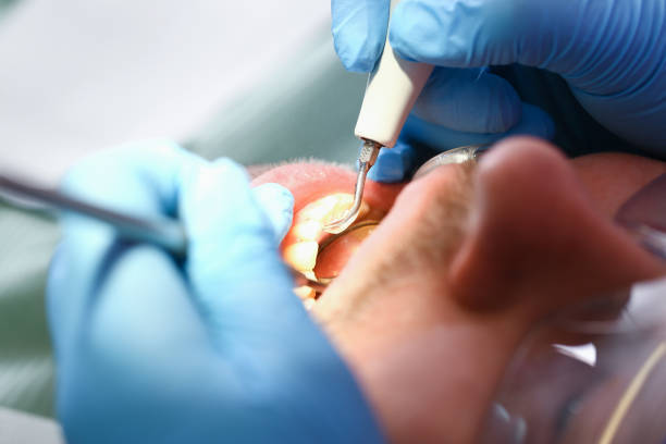 Best Teeth Whitening  in Odessa, MO